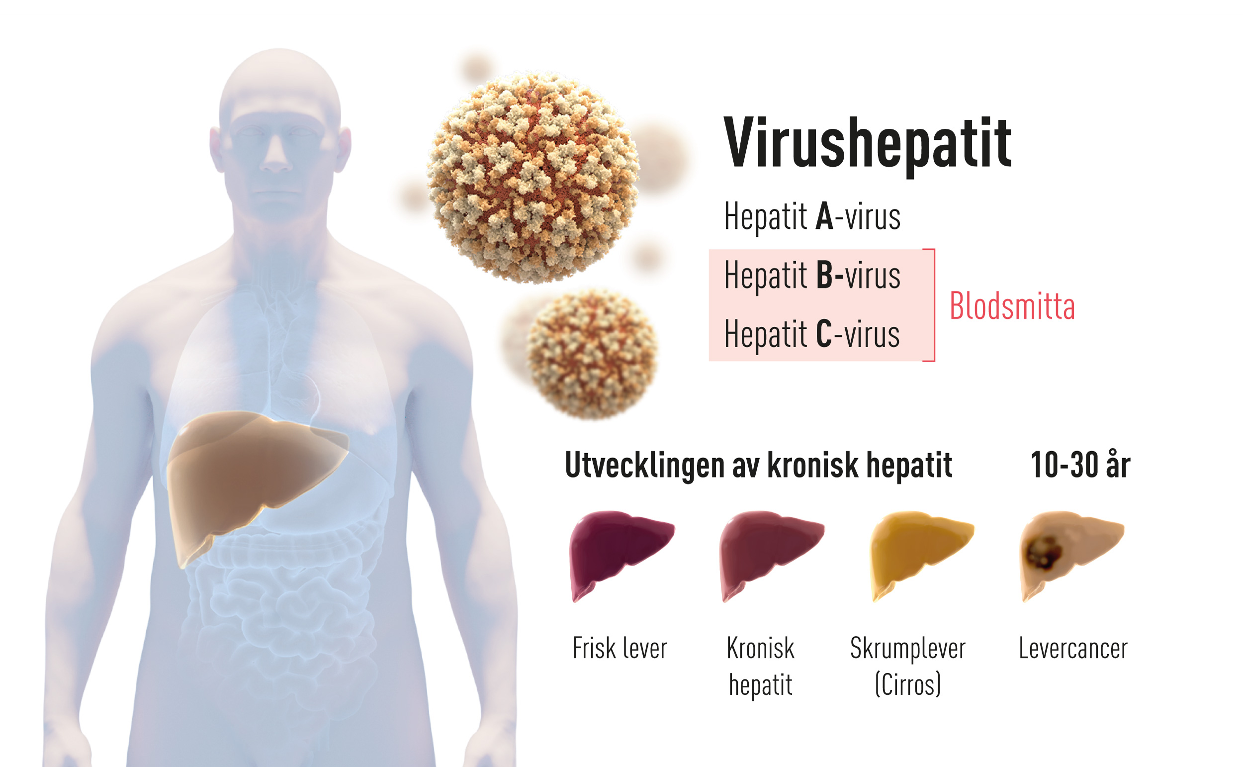 Virushepatit